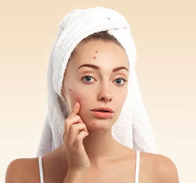 Acne Scar Care